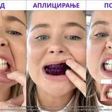 Промотивен Сет - V34 ленти за избелување и Активен Јаглен