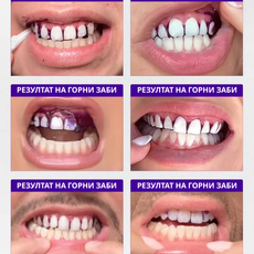 Промотивен Сет - V34 ленти за избелување и Активен Јаглен