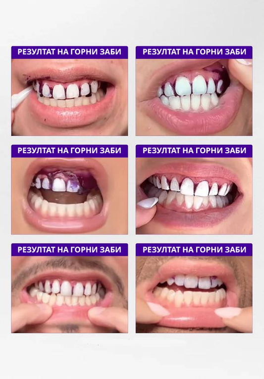 V34 Ленти за избелување заби